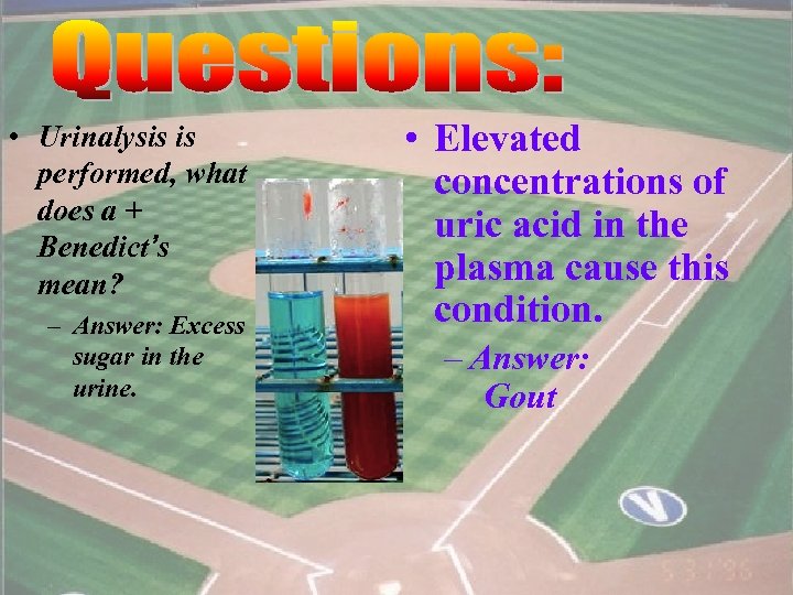  • Urinalysis is performed, what does a + Benedict’s mean? – Answer: Excess