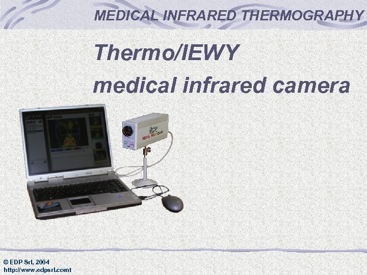 MEDICAL INFRARED THERMOGRAPHY Thermo/IEWY medical infrared camera © EDP Srl, 2004 http: //www. edpsrl.