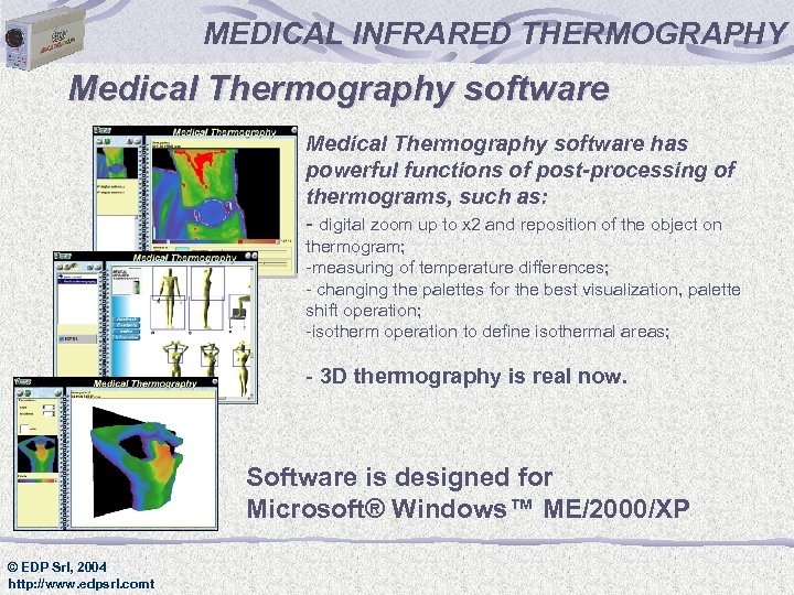 MEDICAL INFRARED THERMOGRAPHY Medical Thermography software has powerful functions of post-processing of thermograms, such