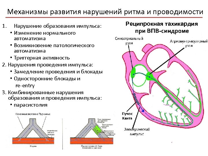 Механизмы развития нарушений ритма и проводимости 1. Нарушение образования импульса: • Изменение нормального автоматизма