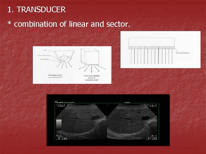 1. TRANSDUCER * combination of linear and sector. . 