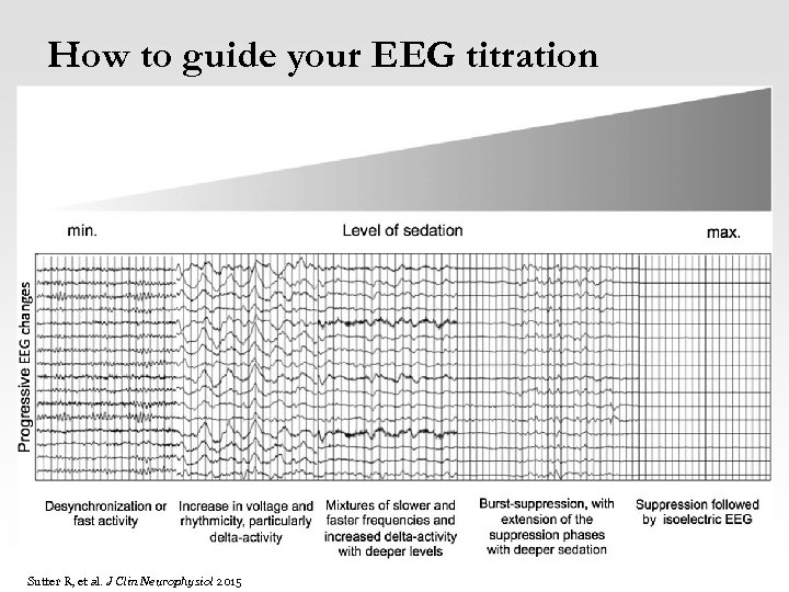 How to guide your EEG titration Sutter R, et al. J Clin Neurophysiol 2015