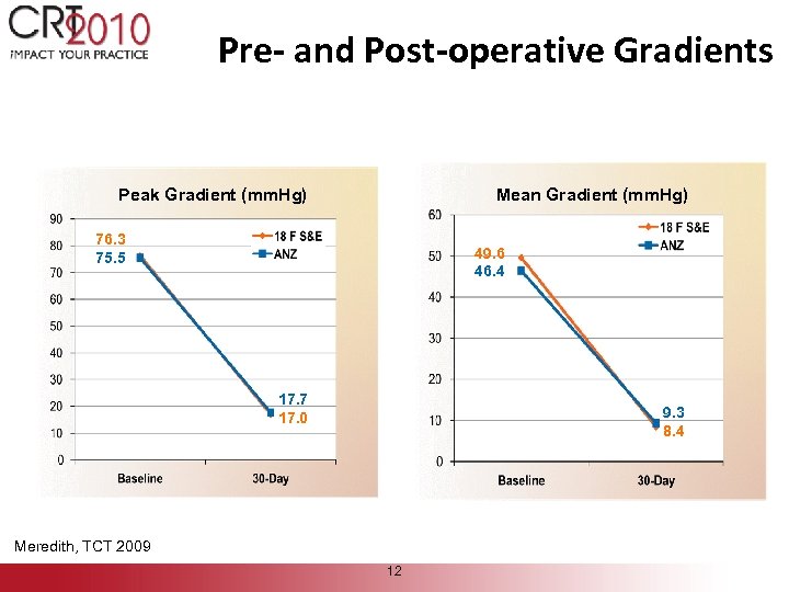Pre- and Post-operative Gradients Peak Gradient (mm. Hg) Mean Gradient (mm. Hg) 76. 3