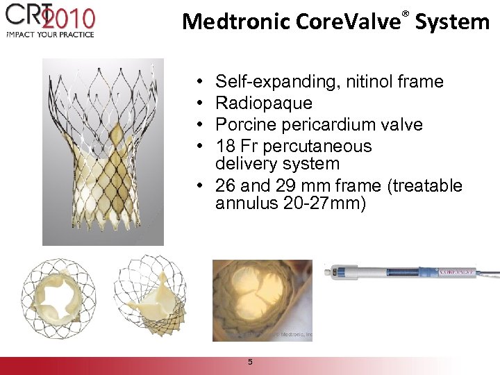 Medtronic Core. Valve® System • • Self-expanding, nitinol frame Radiopaque Porcine pericardium valve 18