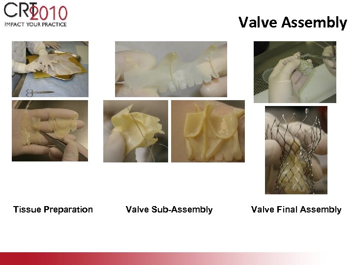 Valve Assembly Tissue Preparation Valve Sub-Assembly Valve Final Assembly 