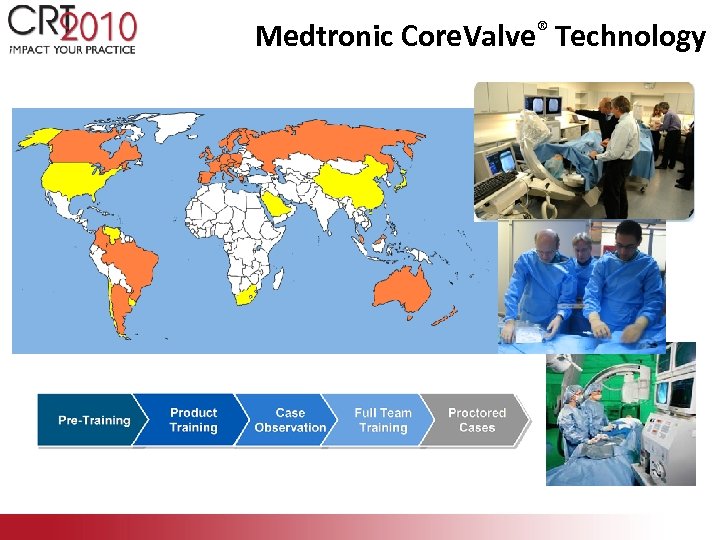 Medtronic Core. Valve® Technology 