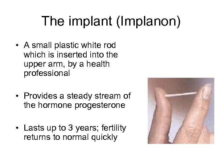 The implant (Implanon) • A small plastic white rod which is inserted into the