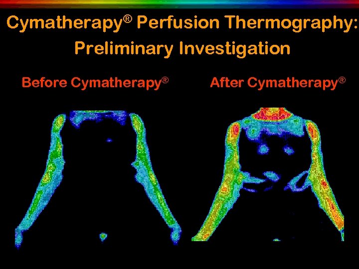 Cymatherapy® Perfusion Thermography: Preliminary Investigation Before Cymatherapy® After Cymatherapy® 