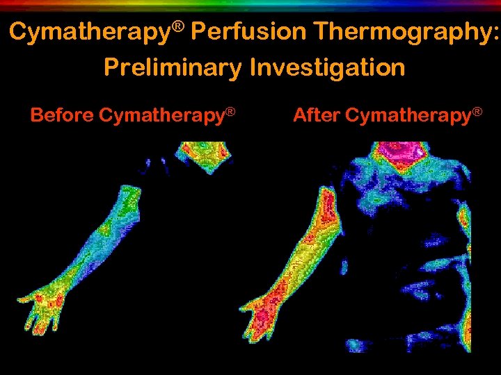 Cymatherapy® Perfusion Thermography: Preliminary Investigation Before Cymatherapy® After Cymatherapy® 