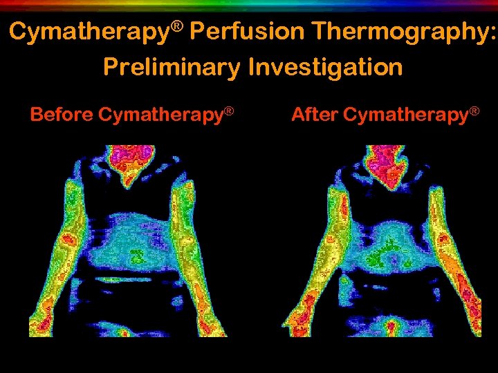 Cymatherapy® Perfusion Thermography: Preliminary Investigation Before Cymatherapy® After Cymatherapy® 
