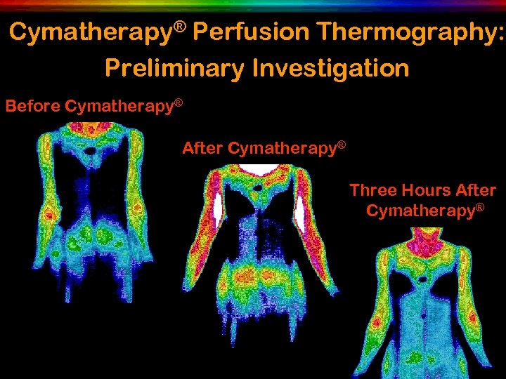 Cymatherapy® Perfusion Thermography: Preliminary Investigation Before Cymatherapy® After Cymatherapy® Three Hours After Cymatherapy® 