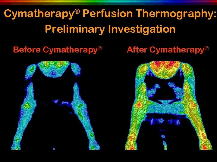 Cymatherapy® Perfusion Thermography: Preliminary Investigation Before Cymatherapy® After Cymatherapy® 