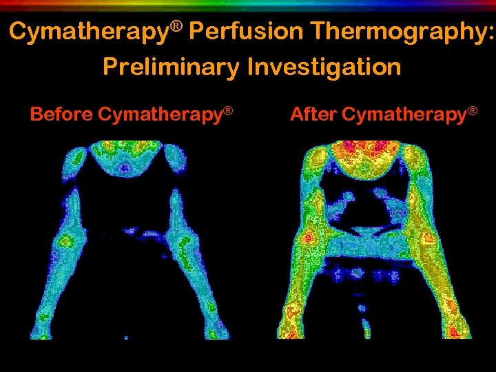Cymatherapy® Perfusion Thermography: Preliminary Investigation Before Cymatherapy® After Cymatherapy® 