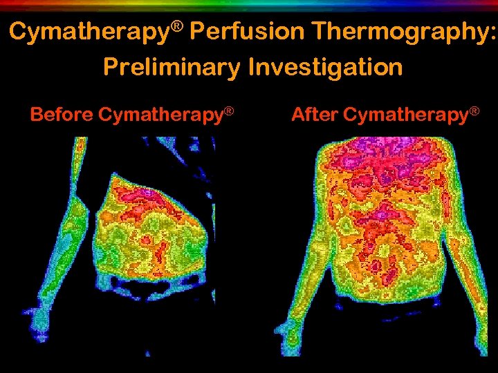 Cymatherapy® Perfusion Thermography: Preliminary Investigation Before Cymatherapy® After Cymatherapy® 