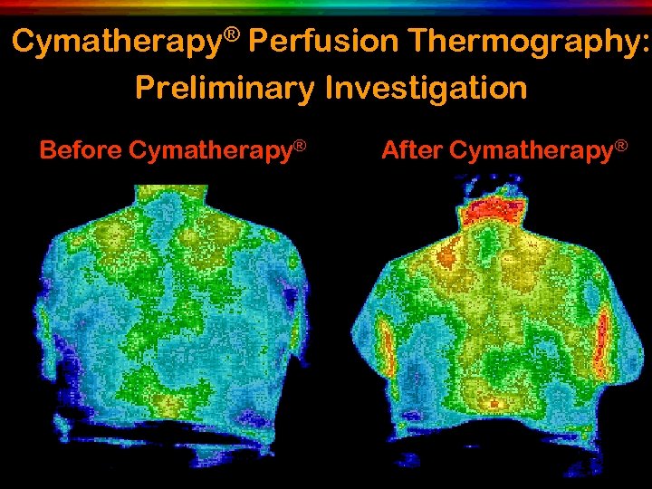 Cymatherapy® Perfusion Thermography: Preliminary Investigation Before Cymatherapy® After Cymatherapy® 