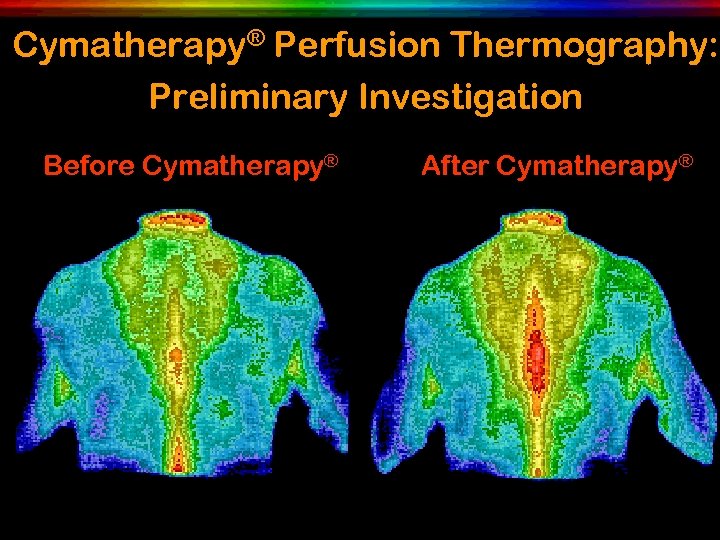 Cymatherapy® Perfusion Thermography: Preliminary Investigation Before Cymatherapy® After Cymatherapy® 