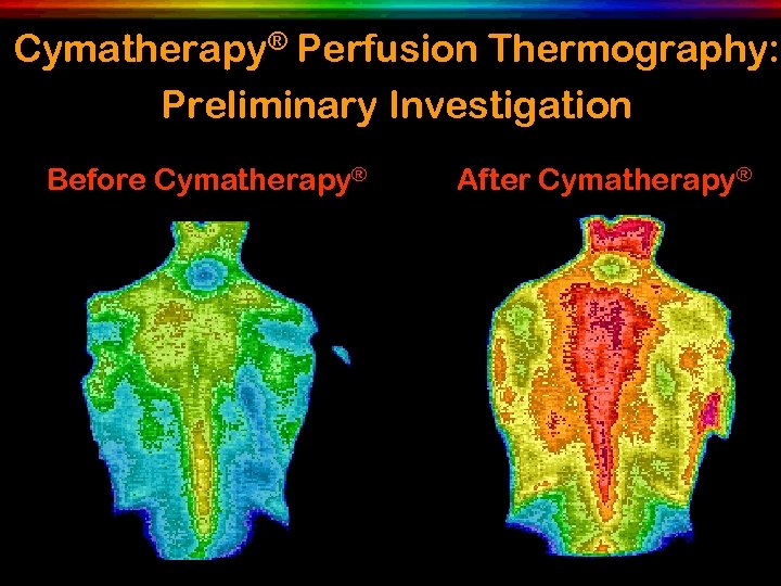 Cymatherapy® Perfusion Thermography: Preliminary Investigation Before Cymatherapy® After Cymatherapy® 