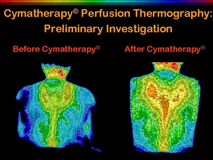 Cymatherapy® Perfusion Thermography: Preliminary Investigation Before Cymatherapy® After Cymatherapy® 