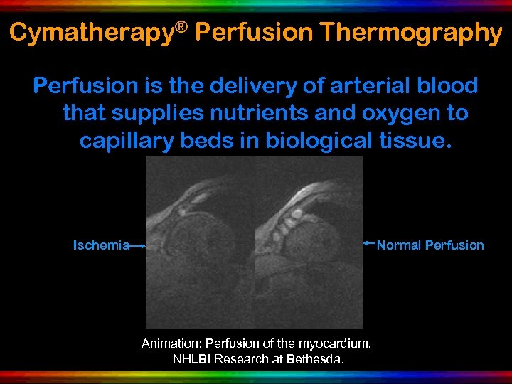 Cymatherapy® Perfusion Thermography Perfusion is the delivery of arterial blood that supplies nutrients and