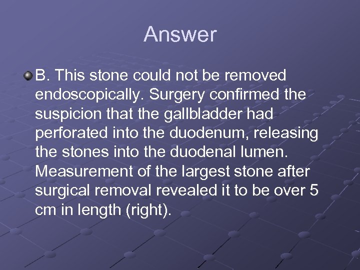 Answer B. This stone could not be removed endoscopically. Surgery confirmed the suspicion that
