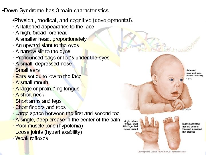  • Down Syndrome has 3 main characteristics • Physical, medical, and cognitive (developmental).