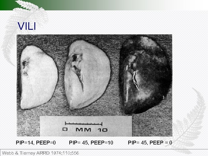 VILI PIP=14, PEEP=0 PIP= 45, PEEP=10 Webb & Tierney ARRD 1974; 110; 556 PIP=