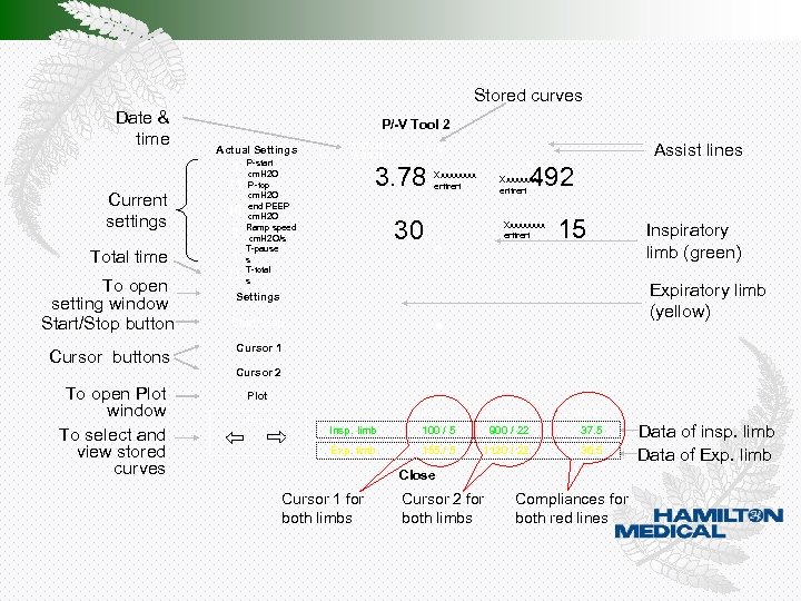 Stored curves Date & time P/-V Tool 2 Actual Settings P-start Current settings Total