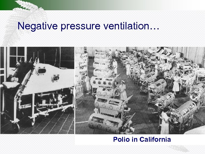 Negative pressure ventilation… Polio in California 