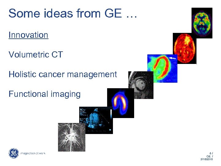 Some ideas from GE … Innovation Volumetric CT Holistic cancer management Functional imaging 8/