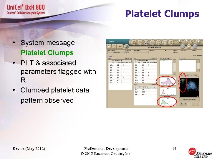 Platelet Clumps • System message Platelet Clumps • PLT & associated parameters flagged with