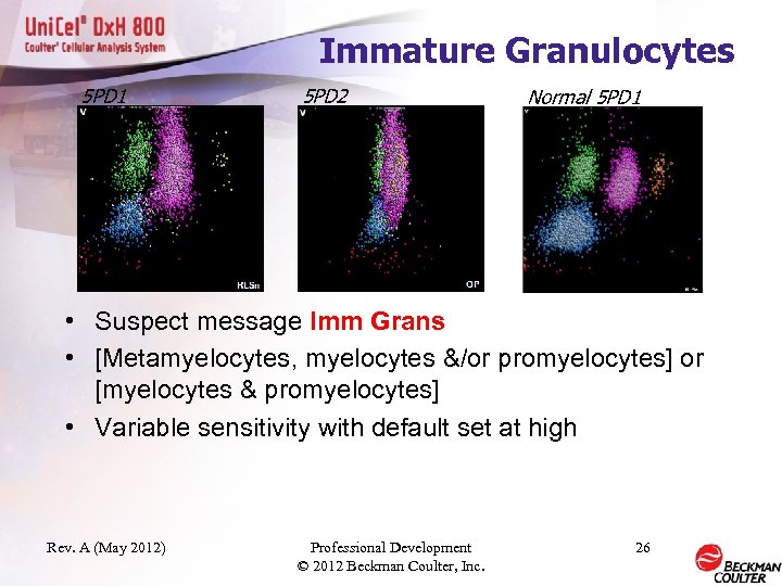 Immature Granulocytes 5 PD 1 5 PD 2 Normal 5 PD 1 • Suspect