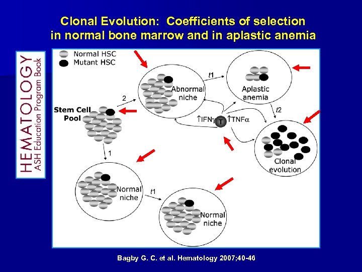 Clonal Evolution: Coefficients of selection in normal bone marrow and in aplastic anemia Bagby