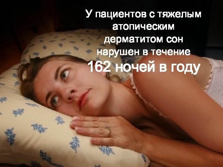 У пациентов с тяжелым атопическим дерматитом сон нарушен в течение 162 ночей в году