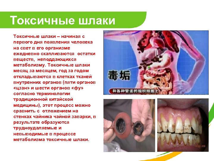 Токсичные шлаки – начиная с первого дня появления человека на свет в его организме