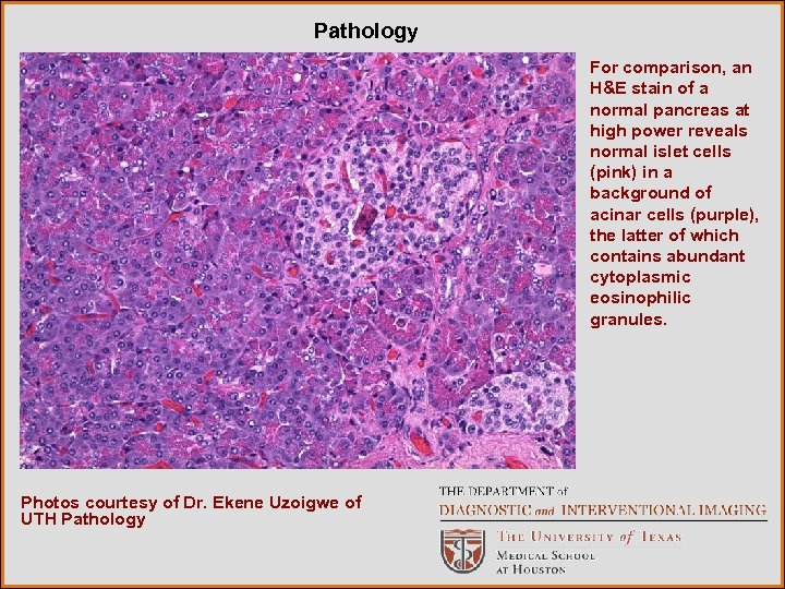 Pathology For comparison, an H&E stain of a normal pancreas at high power reveals