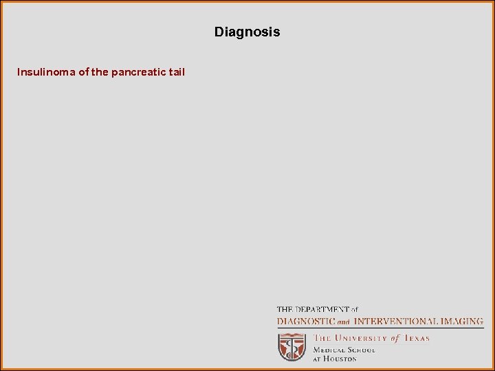 Diagnosis Insulinoma of the pancreatic tail 