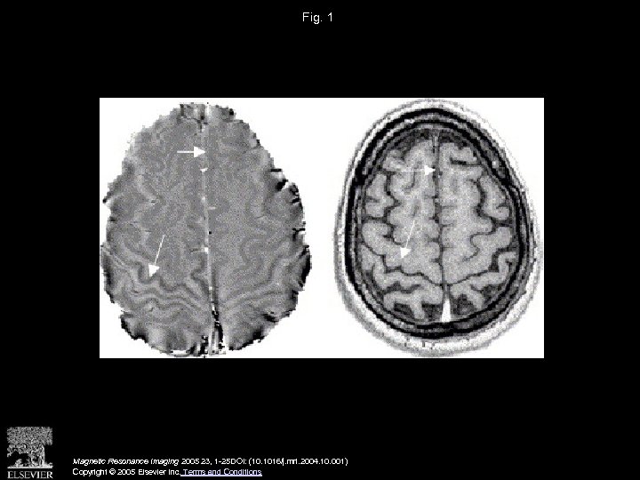 Fig. 1 Magnetic Resonance Imaging 2005 23, 1 -25 DOI: (10. 1016/j. mri. 2004.