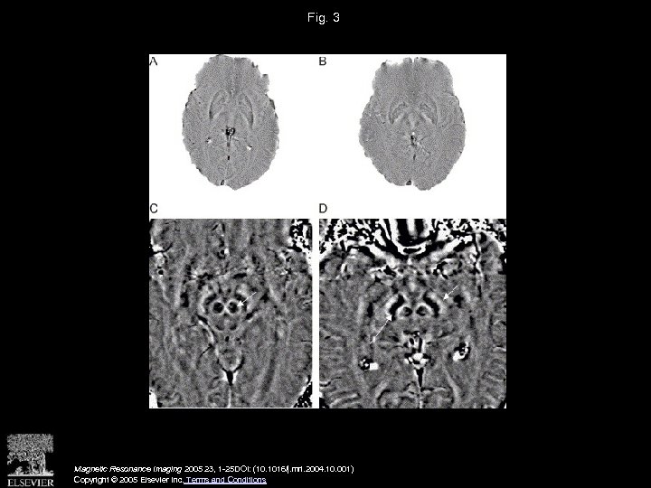 Fig. 3 Magnetic Resonance Imaging 2005 23, 1 -25 DOI: (10. 1016/j. mri. 2004.