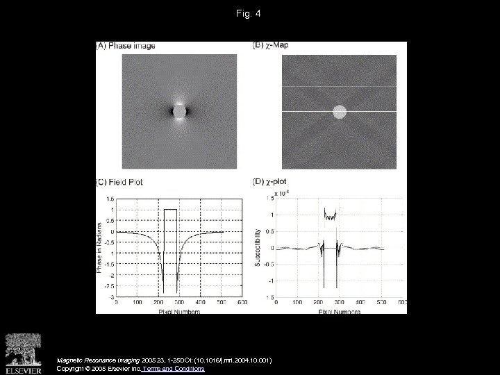 Fig. 4 Magnetic Resonance Imaging 2005 23, 1 -25 DOI: (10. 1016/j. mri. 2004.