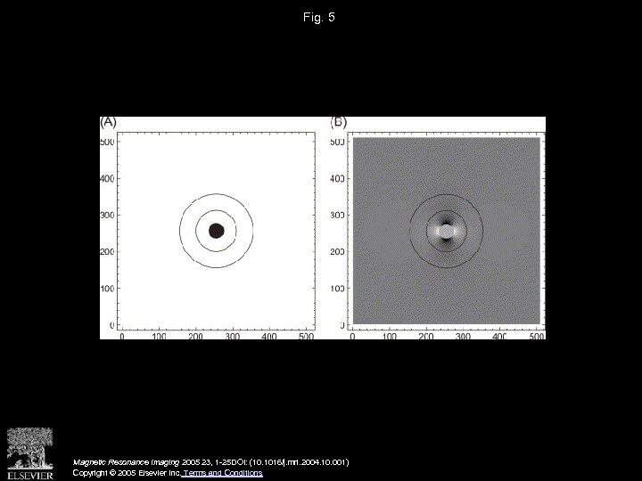 Fig. 5 Magnetic Resonance Imaging 2005 23, 1 -25 DOI: (10. 1016/j. mri. 2004.