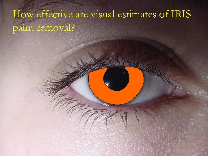 How effective are visual estimates of IRIS paint removal? 