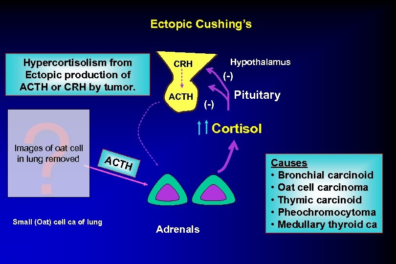 Ectopic Cushing’s Hypercortisolism from Ectopic production of ACTH or CRH by tumor. ? Images
