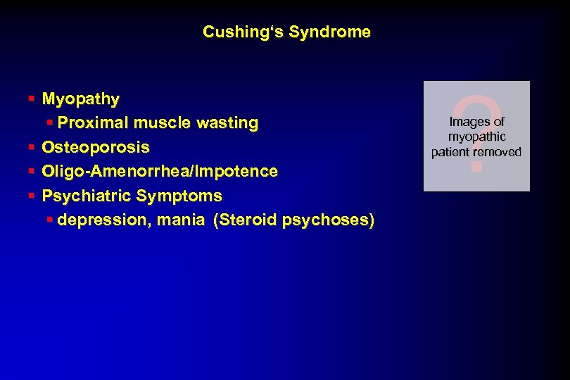 Cushing‘s Syndrome § Myopathy § Proximal muscle wasting § Osteoporosis § Oligo-Amenorrhea/Impotence § Psychiatric