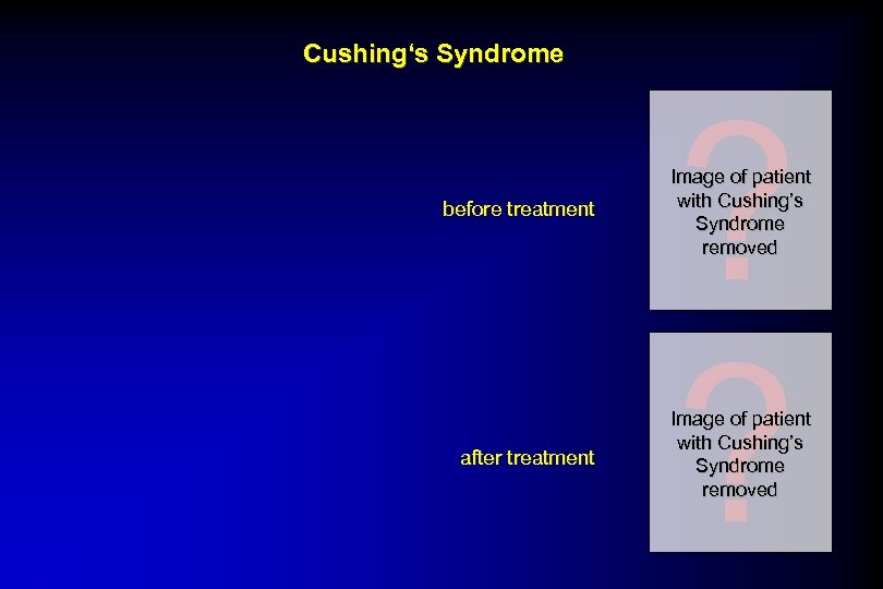 Cushing‘s Syndrome ? ? before treatment Image of patient with Cushing’s Syndrome removed after
