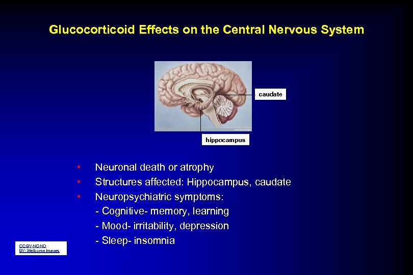 Glucocorticoid Effects on the Central Nervous System caudate hippocampus • • • CC: BY-NC-ND