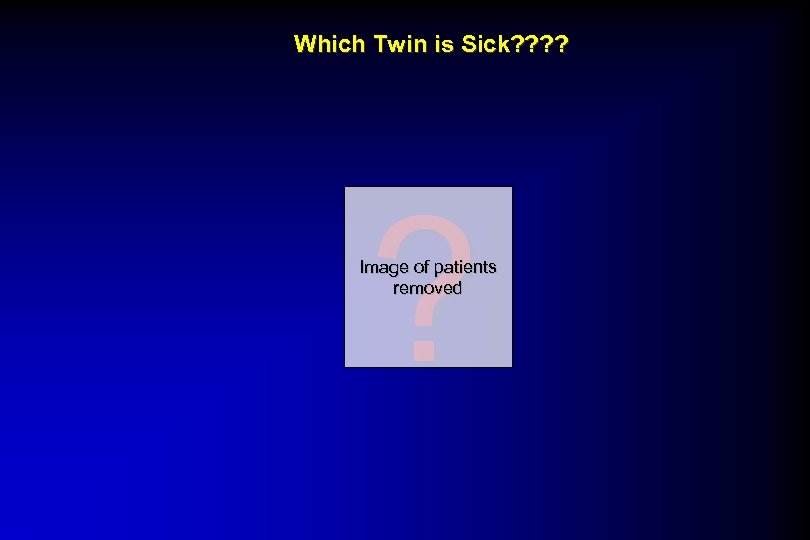 Which Twin is Sick? ? ? Image of patients removed 