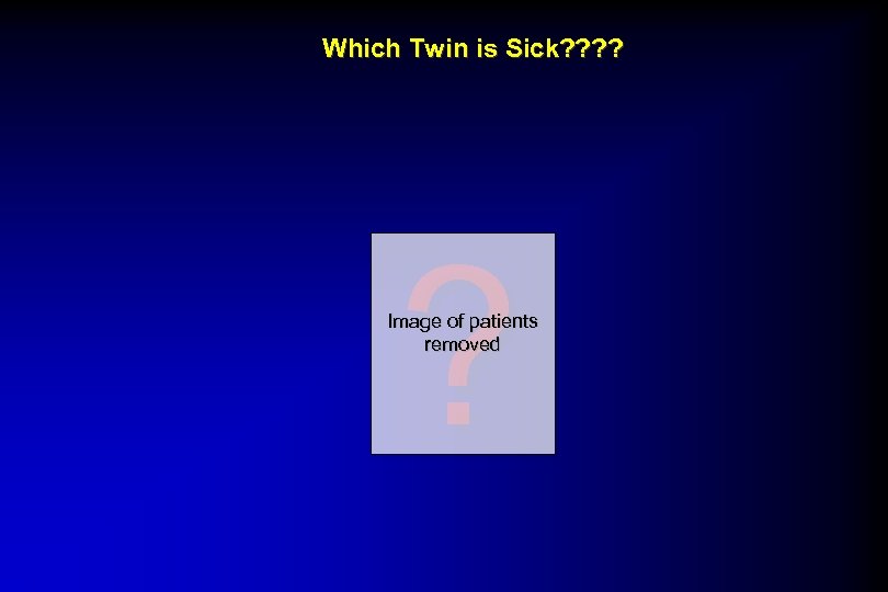 Which Twin is Sick? ? ? Image of patients removed 