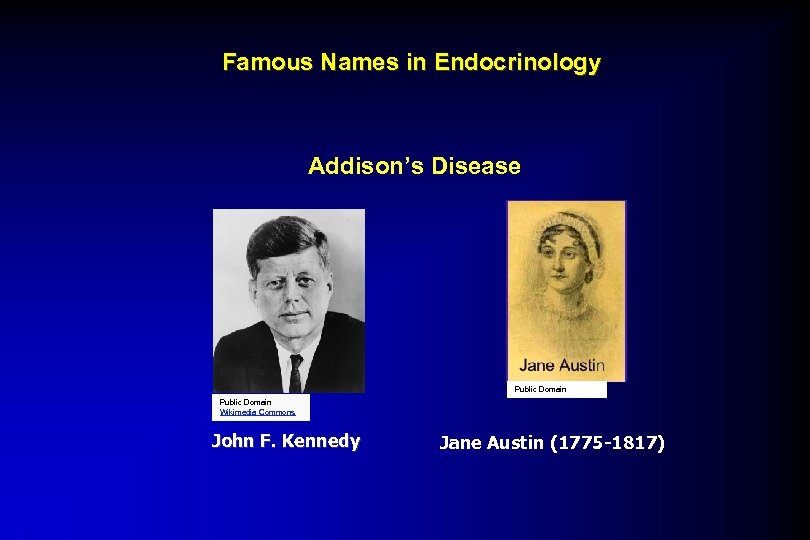 Famous Names in Endocrinology Addison’s Disease Public Domain Wikimedia Commons John F. Kennedy Jane