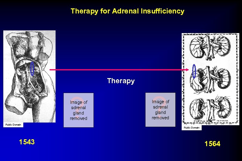 Therapy for Adrenal Insufficiency Therapy ? Image of adrenal gland removed Public Domain 1543