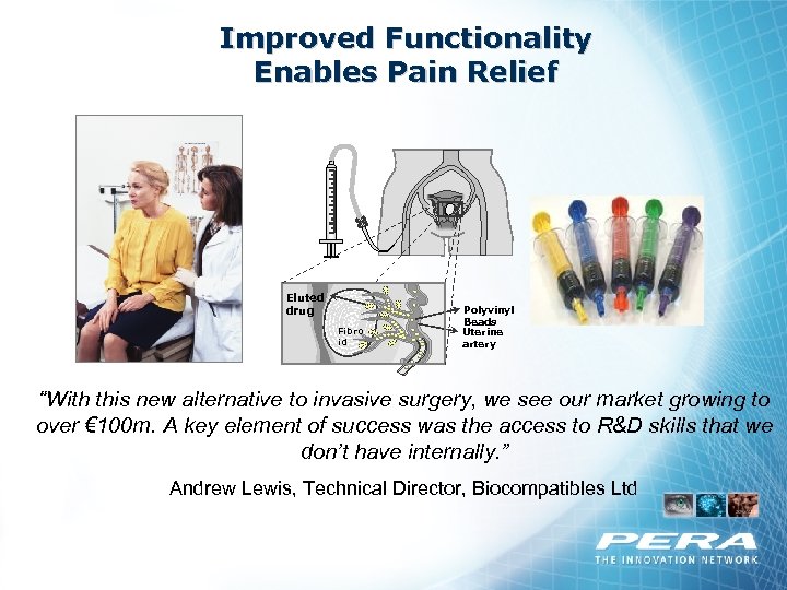 Improved Functionality Enables Pain Relief Eluted drug Fibro id Polyvinyl Beads Uterine artery “With